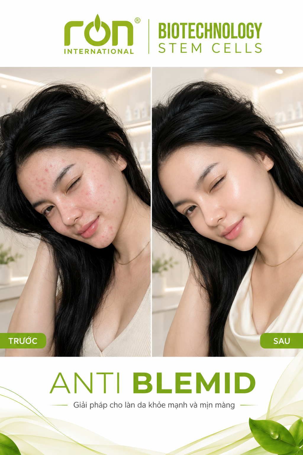 DR.BEFACE ANTI BLEMID ACNE 5ML – TINH CHẤT CHĂM SÓC DA DẦU, DA DỄ NỔI MỤN – 5ml/lọ